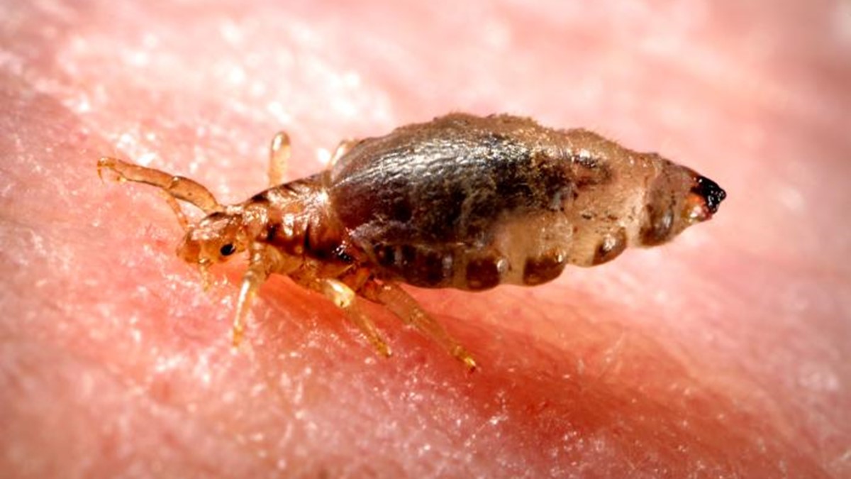 Pediculus humanus corporis, the human body louse.