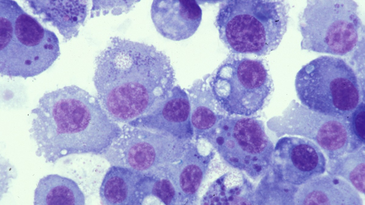 Ehrlichia chaffeensis bacteria in DH83 cell culture (Diff-Quik stain).