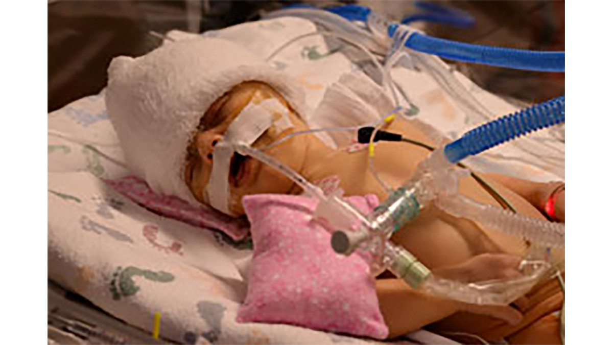 Olive in the hospital Baby Olive hooked up to machines in the ICU
