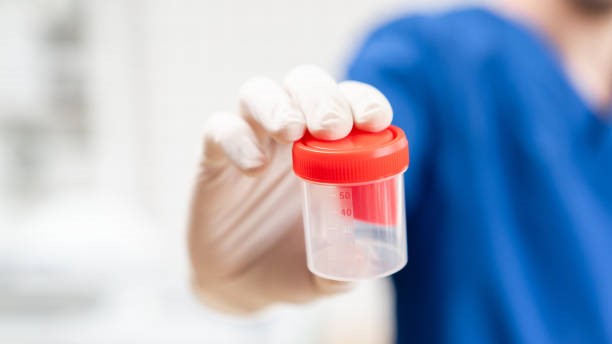 Female nurse holding a urine cup for a patient.