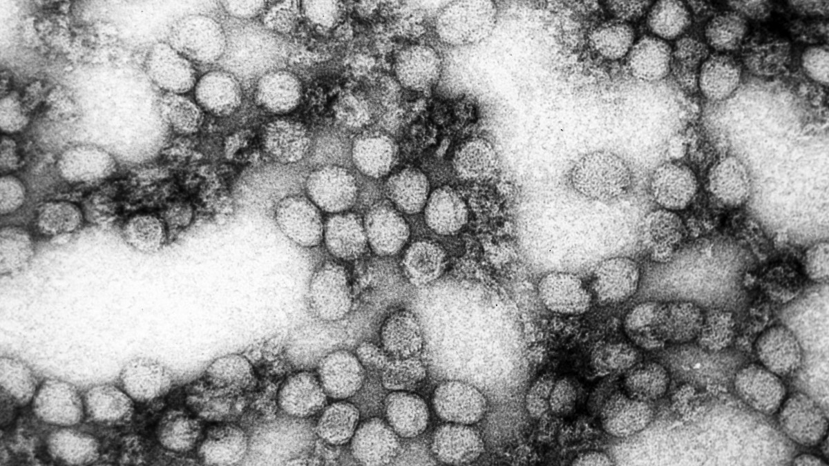Electron microscopic image of numerous yellow fever virions.