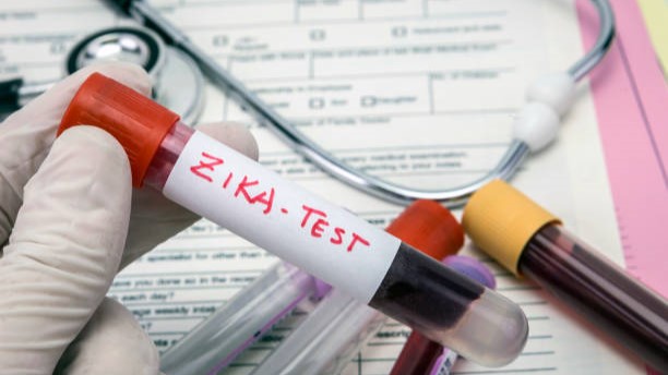 Lab worker holding a tube of blood labeled "Zika Test."