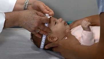A doctor measures the head circumference of an infant.