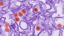 Transmission electron micrograph image of the Zika virus.
